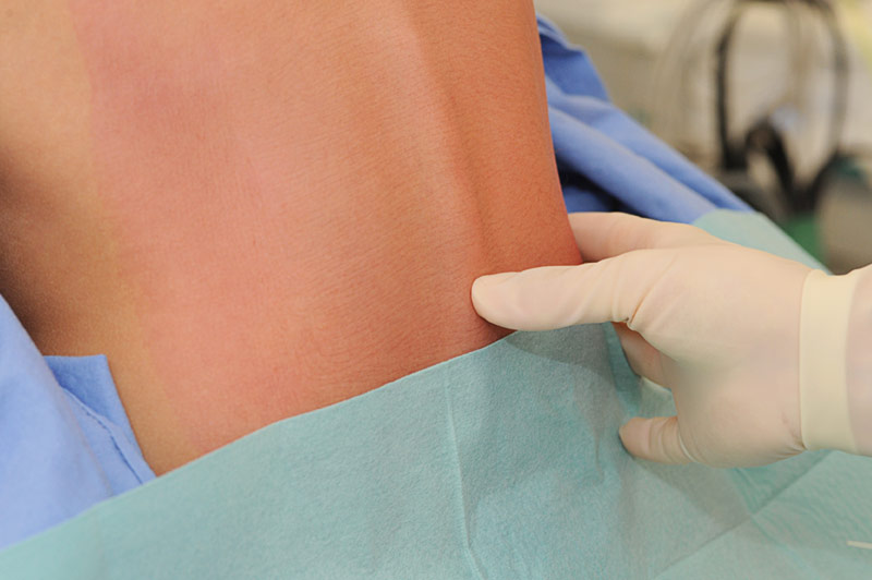 herniastraat
