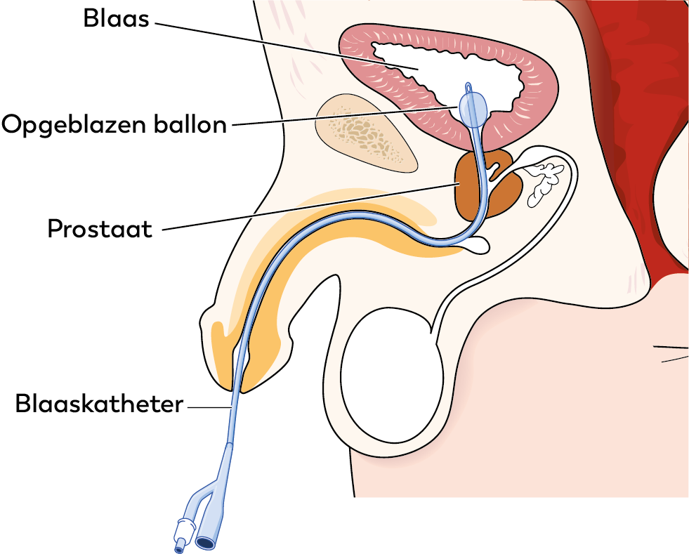 URO000 A.png