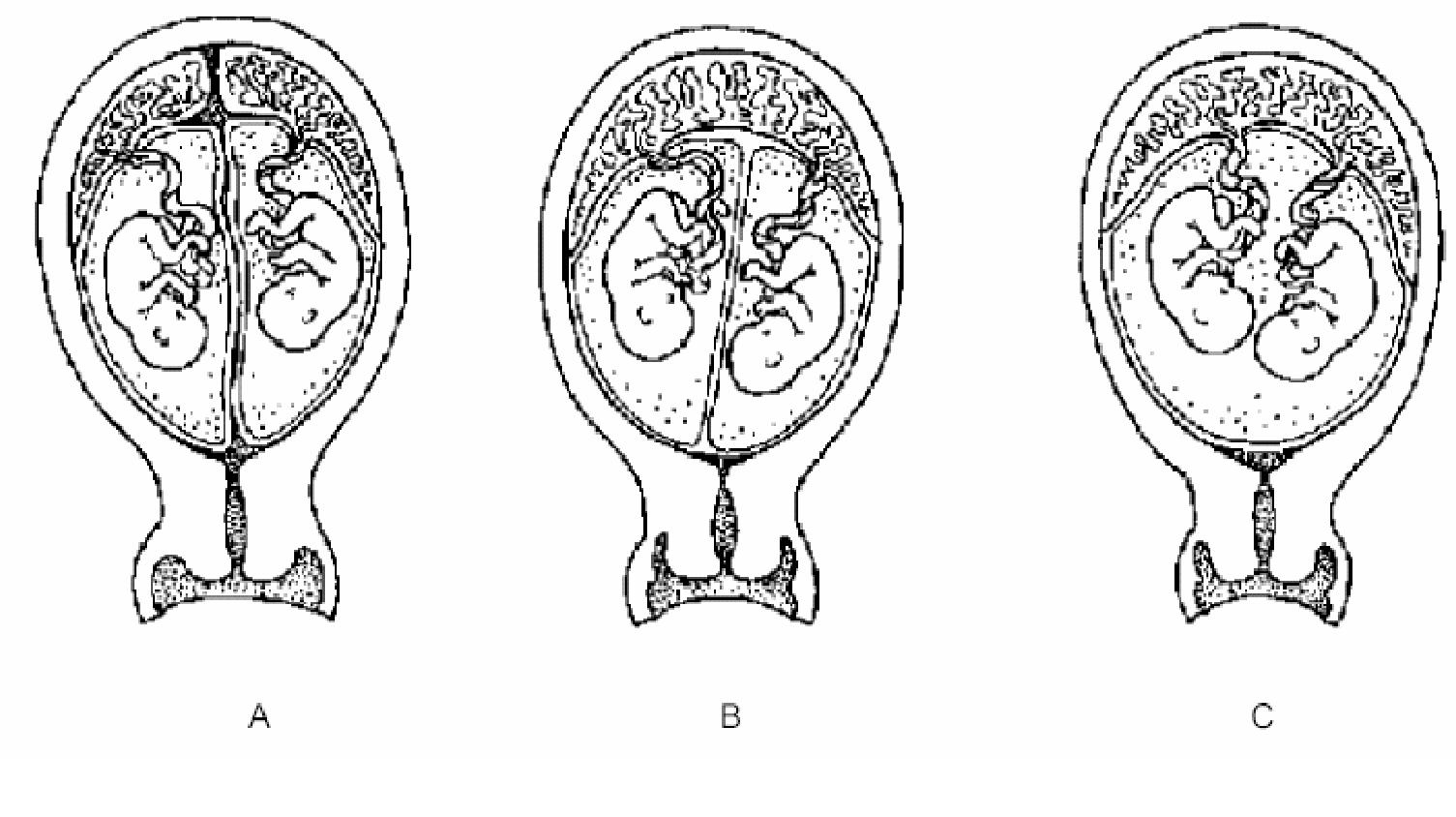 GYN068 A.png