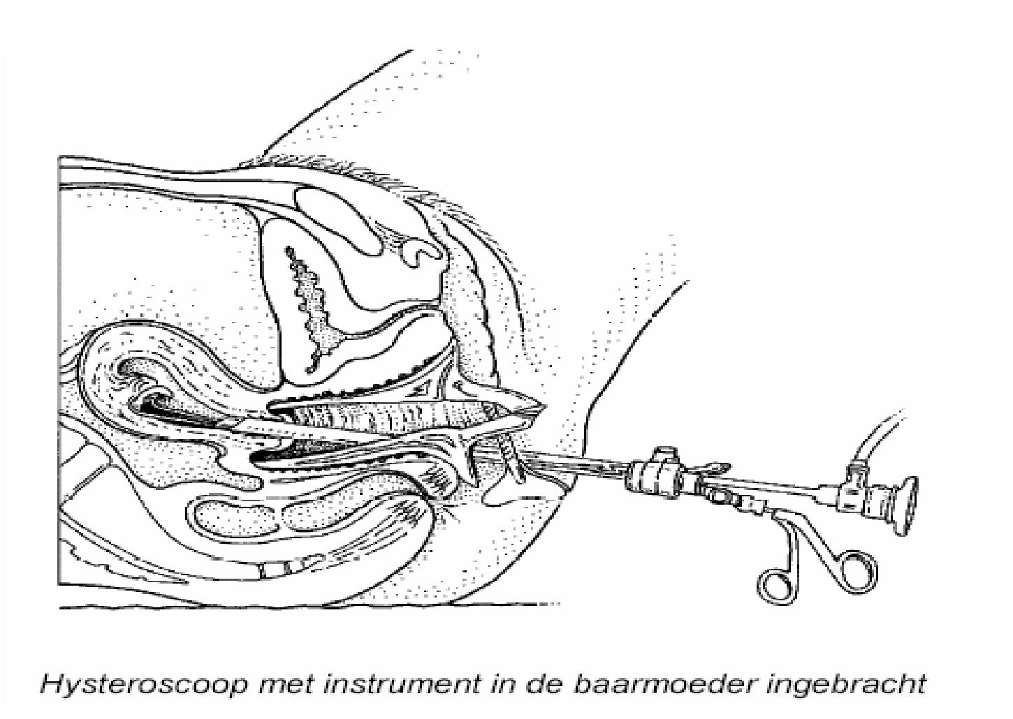 GYN088 A.png