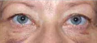 OOG001 J.png