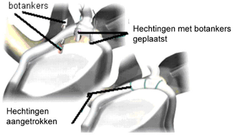 ORT021 F.jpg