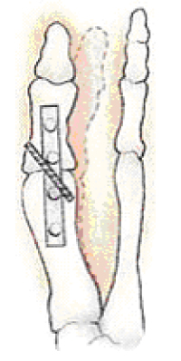 ORT023 B.jpg