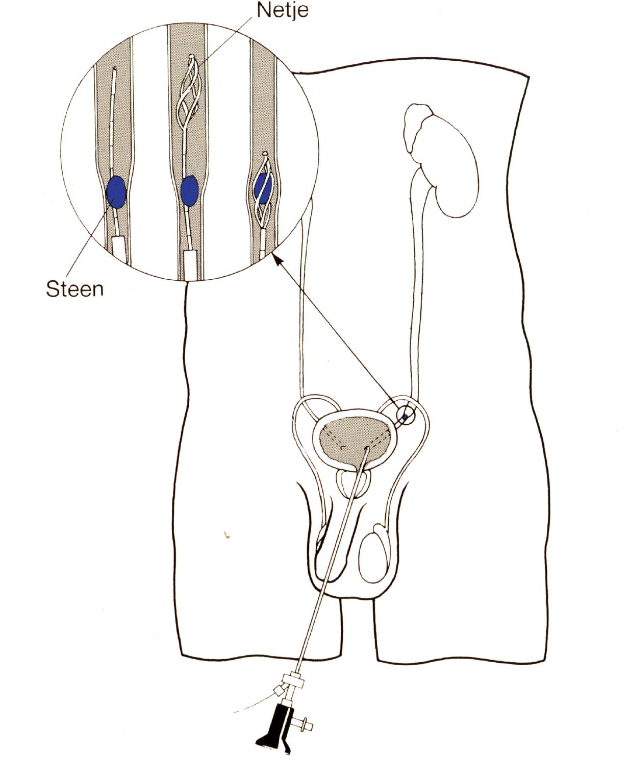 URO030 A.png