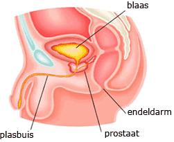 Urolift 2.png