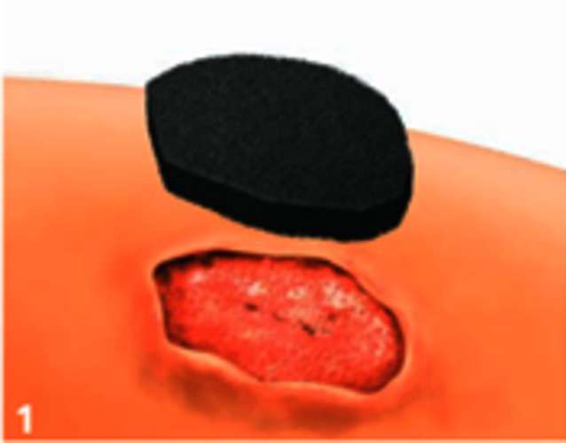 CHI-071 stap 1.png