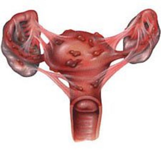 GYN057 B.tif