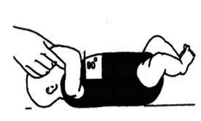 Gebrokensleutelbeen_baby_afb3.jpg