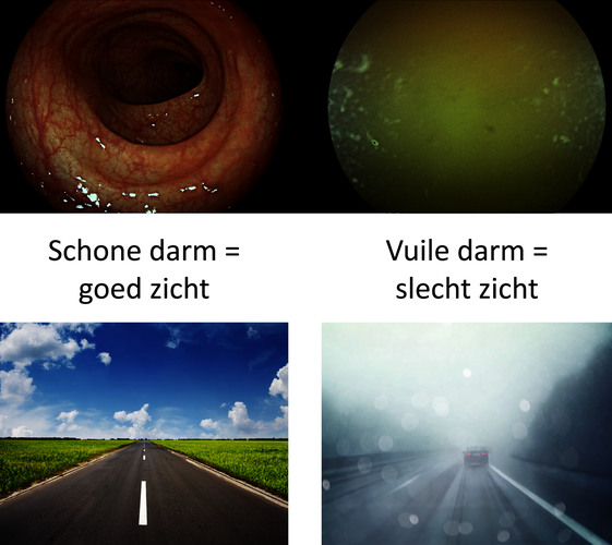 MDL-031 zicht coloscopie.jpg