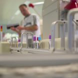 Onderzoek naar betere diagnose bij longkanker krijgt 1,1 miljoen euro subsidie